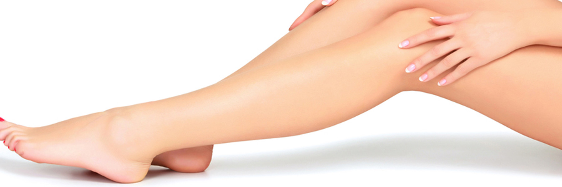 Varicose Veins