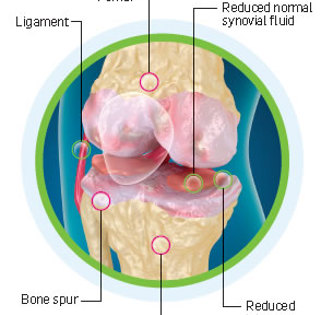 knee_joint.jpg