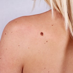 Expert advice on problem skin conditions