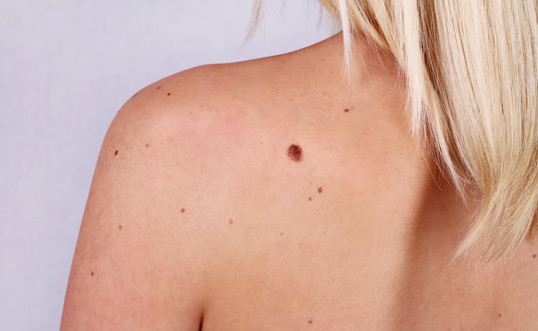 Expert advice on problem skin conditions